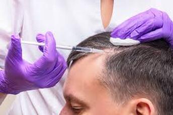 Androgenetic Alopecia Treatment - Our Vishwas